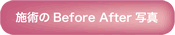 Before＆Afterはこちらへ